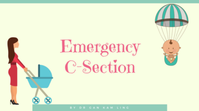 Emergency-C-section